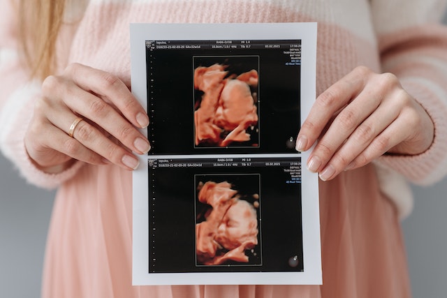 Da Vinci Klinika Pecs 4d Ultrahang () Da Vinci Klinika Pecs 4d Ultrahang